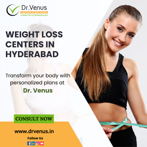 weight-loss-centers-in-hyderabad-22.png