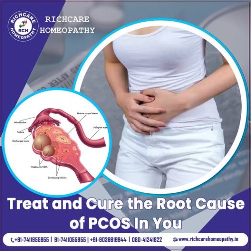 PCOD-Homeopathy-Treatments-in-Bangalore--Rich-Care.jpg