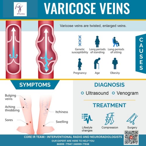 Get-Varicose-Veins-Relief-by-Dr.-Sandeep-Sharma-in-Mohali.jpg