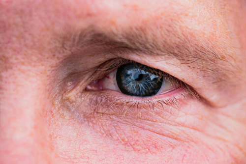Getting-Ready-for-Eye-Surgery-Oklahoma-3.png