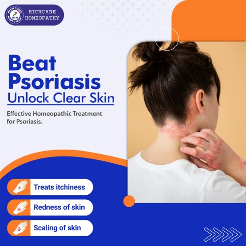 Psoriasis--01.jpg