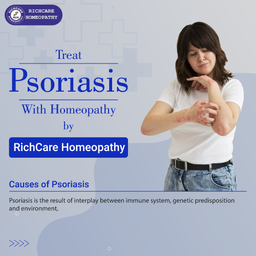 Richcare-Homeopathy-Carousel-ad-3-Psoriasis-01.png