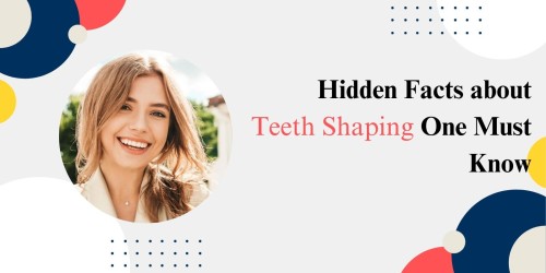 Hidden-Facts-about-Teeth-Shaping-One-Must-Know.jpg
