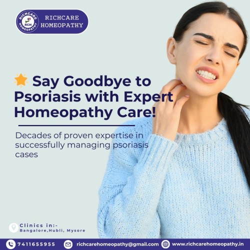Psoriasis-Homeopathy-Treatments-in-Bangalore--Rich-Care.jpg