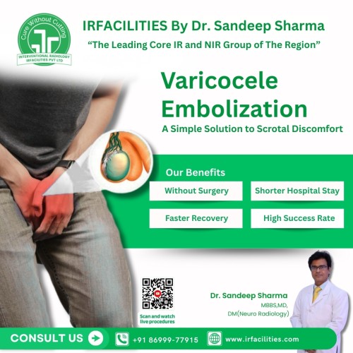 Advanced-Varicocele-Treatment-with-Dr.-Sandeep-Sharma-at-IRFacilities.jpg
