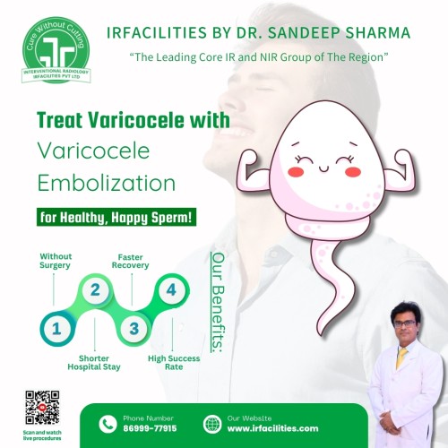 Treat-Varicocele-with-Varicocele-Embolization-in-India-at-IRFACILITIES.jpg