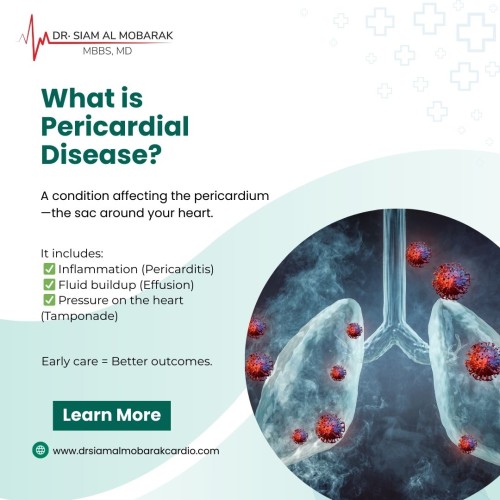 dr-siam-what-is-pericardial-disease.jpg