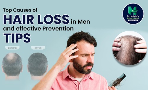 15.Top-Causes-of-Hair-Loss-in-Men-and-How-to-Prevent-It.jpg