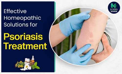 18.Psoriasis-Treatment-in-Homeopathy.jpg