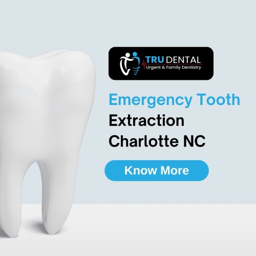 Emergency-tooth-extraction-charlotte-NC.jpg