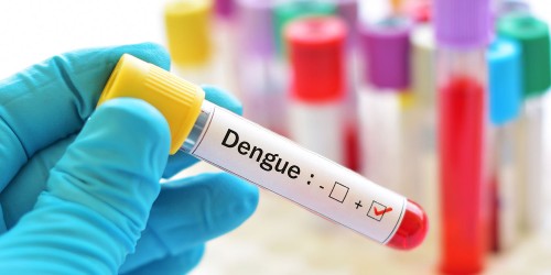 Signs-and-Symptoms-of-Dengue-Fever.jpg