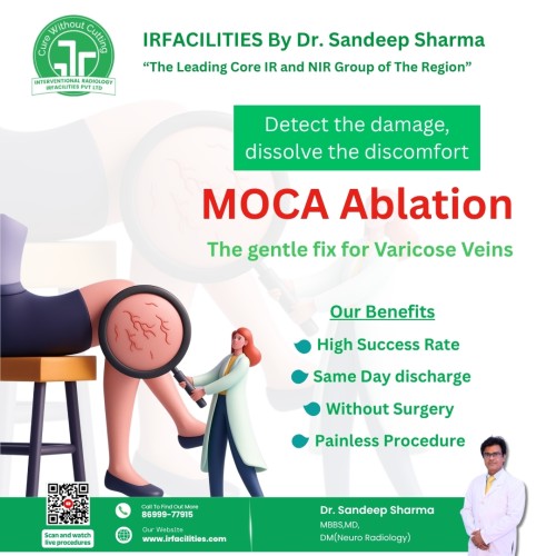 Gentle-Stitch-Free-Varicose-Vein-Treatment-by-Dr.-Sandeep-Sharma.jpg
