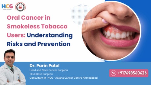 Oral-Cancer-1-1024x576111.jpg
