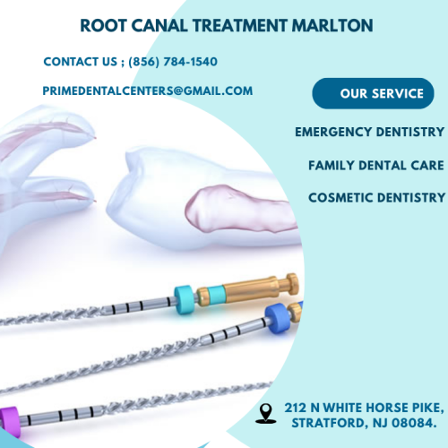 root-canal-treatment-Marlton.png