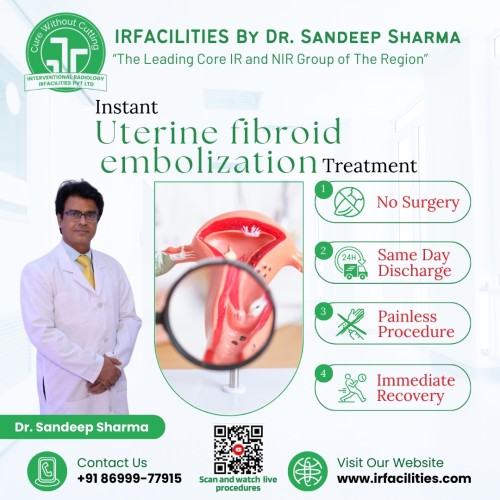 Instant-Uterine-Fibroid-Embolization-Treatment-by-IRFACILITIES.jpg