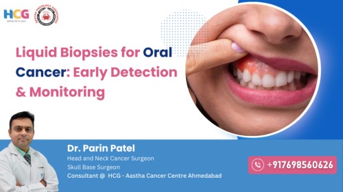 Liquid-Biopsies-for-Oral-Cancer-1024x576111.jpg