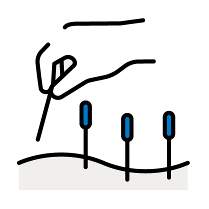 Illustrated-icon-acupuncture.png