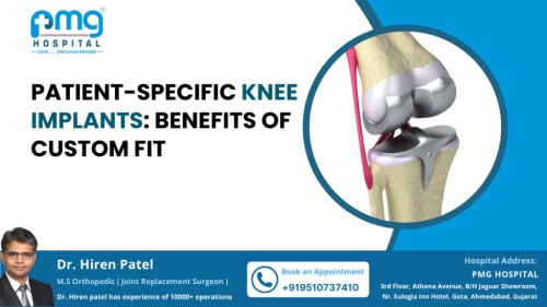 Patient-Specific-Knee-Implants-1024x576111.jpg