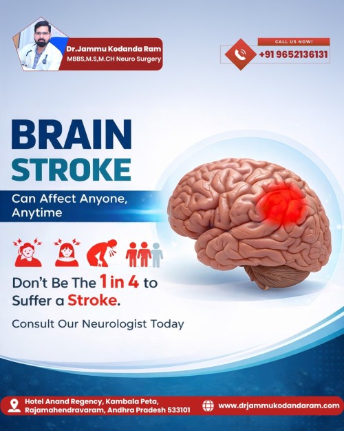 -Brain-Stroke-Can-Affect-Anyone-Anytime.A-stroke-doesnt-come-with-a-warning--but-awareness.jpg