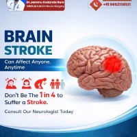 -Brain-Stroke-Can-Affect-Anyone-Anytime.A-stroke-doesnt-come-with-a-warning--but-awareness