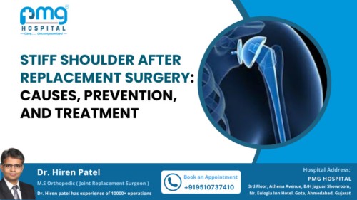Shoulder-After-Replacement-Surgery-768x432-1111.jpg