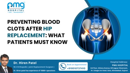 Preventing-Blood-Clots-After-Hip-Replacement-768x432111.jpg