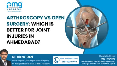 Arthroscopy-Surgery-768x432111.jpg