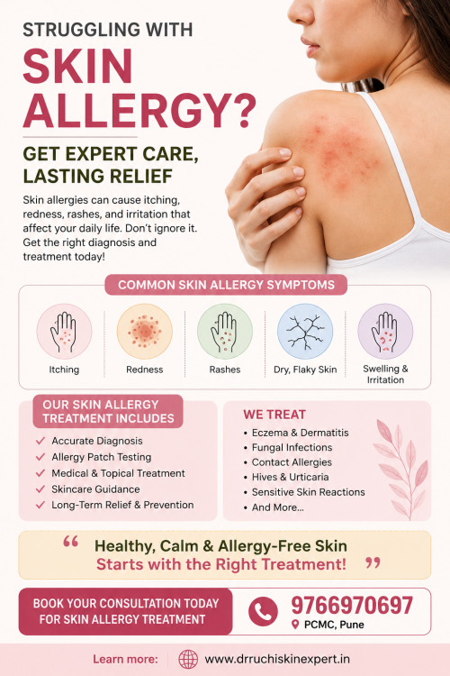 skin-allergy-treatement.png