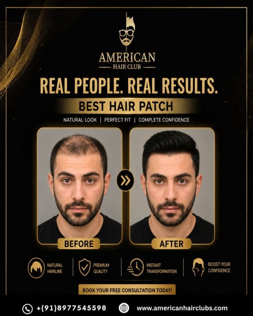 -Best-Hair-Patch.-Instant-Confidence--Real-People.-Real-Results.-Stop-letting-hair-loss-def.jpg