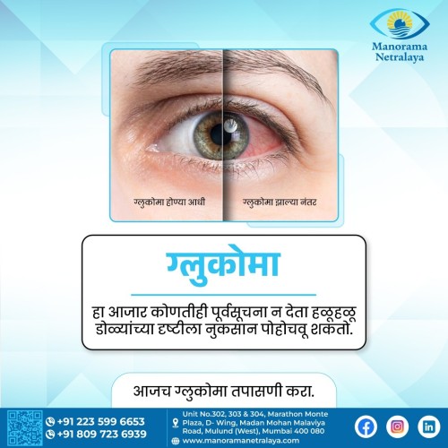 Advanced-Glaucoma-Treatment-in-Thane--Manorama-Netralaya.jpg